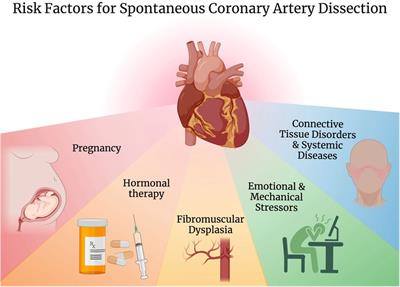 Spontaneous coronary artery dissection and fibromuscular dysplasia: insights into recent developments